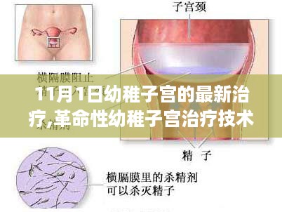 革命性幼稚子宫智能疗法，11月新纪元引领科技治疗新突破